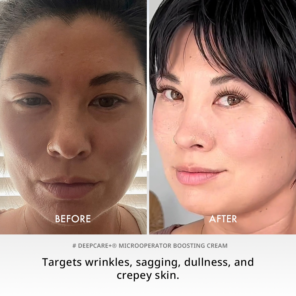 Deepcare+® MicroOperator Boosting Cream - Beginner
