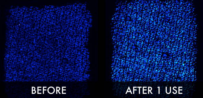 Clinical trial image