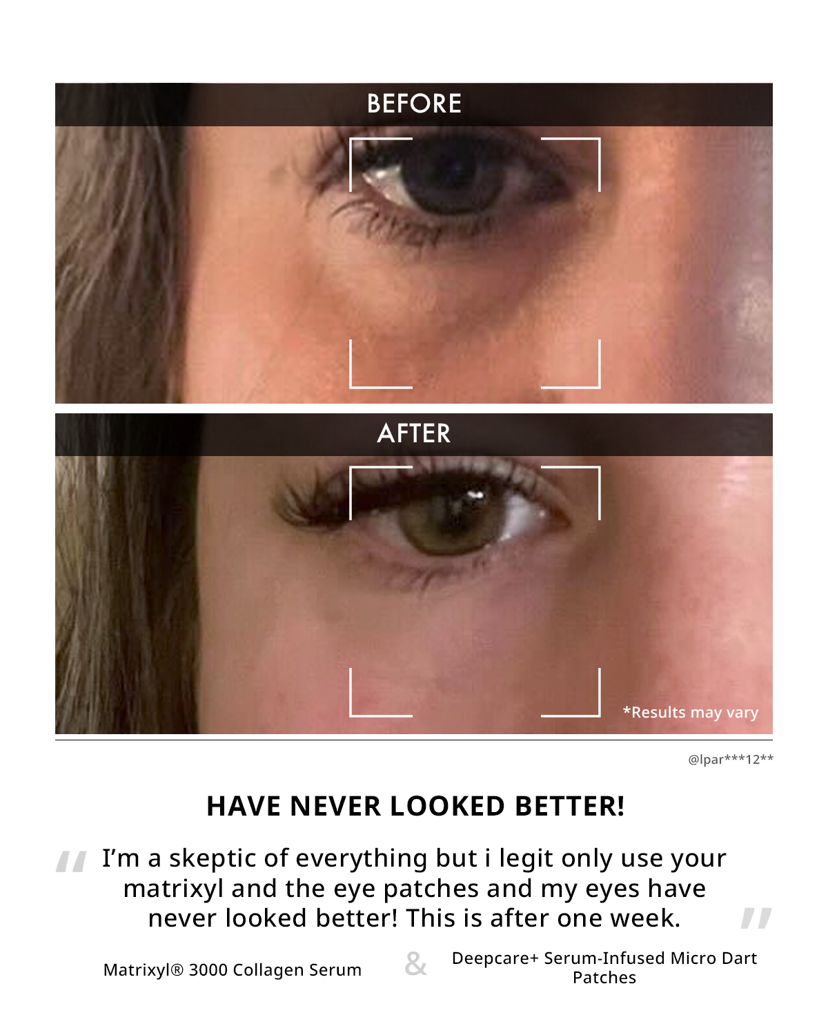 Deepcare Serum Infused Anti Wrinkle Micro Dart Patch