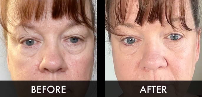 Clinical trial image