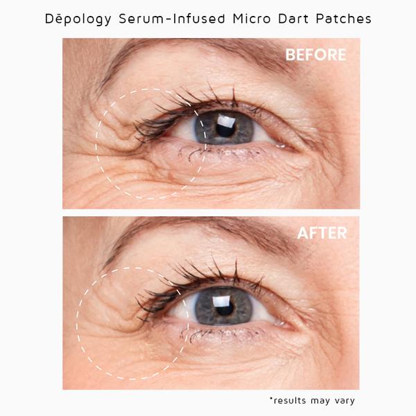 Deepcare Serum Infused Micro Dart Patches