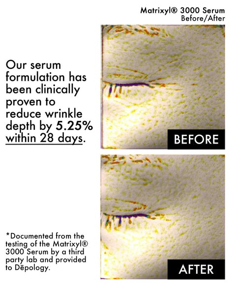 Depology Before And After