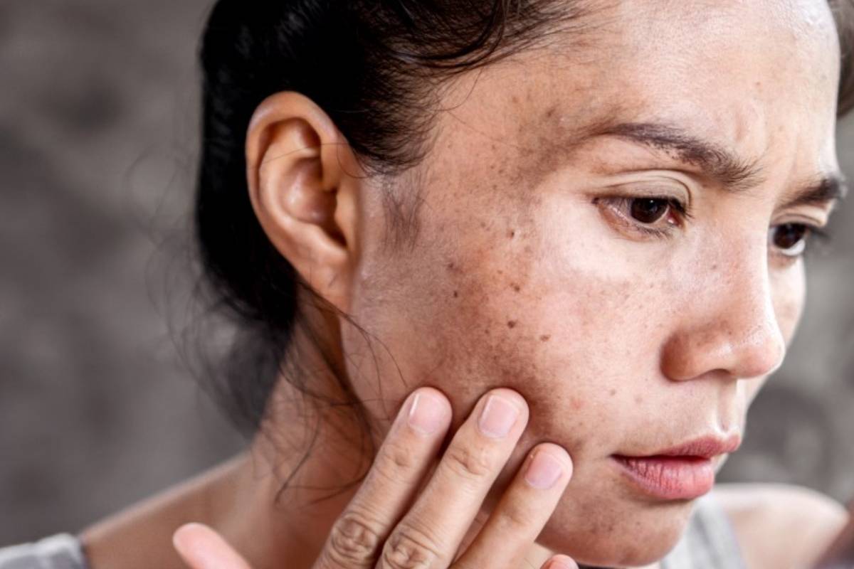 How to Stop Itchy Skin in Cold Weather | Winter Skincare Tips