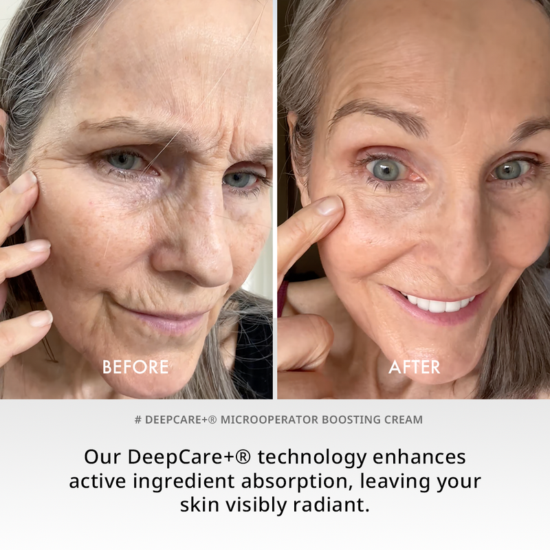 Deepcare+® MicroOperator Boosting Cream - Beginner [US EXCLUSIVE ONLY]