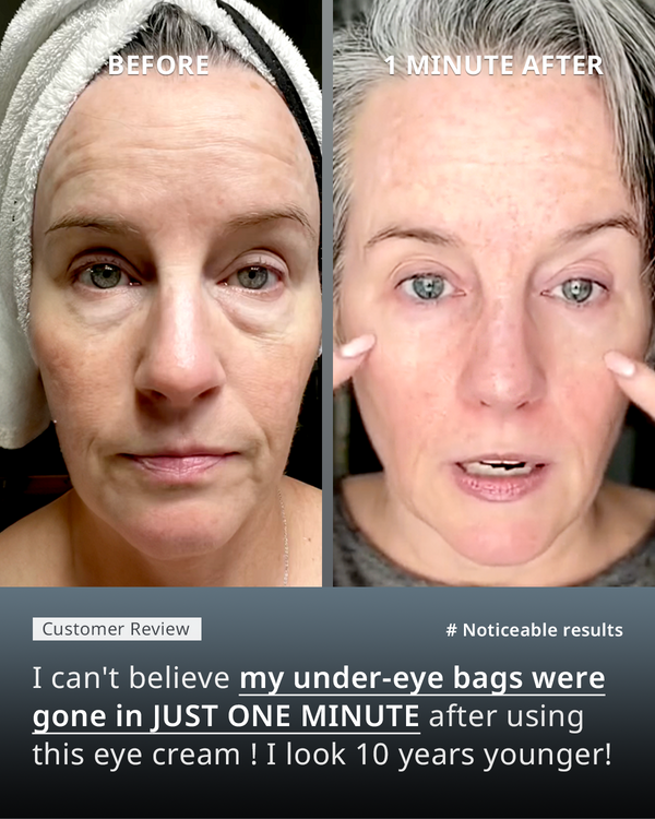 DEEPCARE+® X-DART INSTANT UNDER EYE BAG SOLUTION