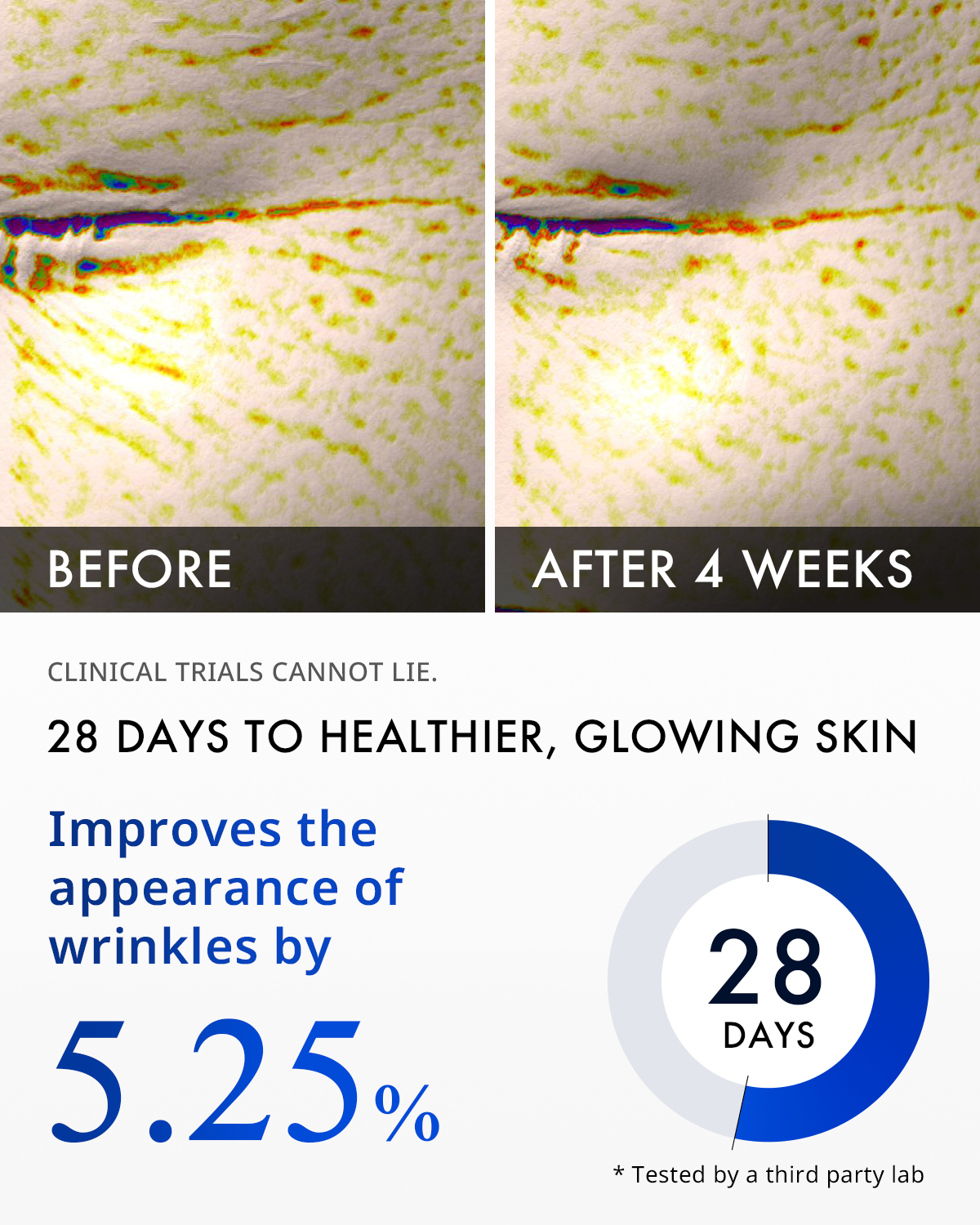 OFFER: Matrixyl® 3000 Collagen Serum Trio