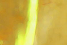MATRIXYL® 3000