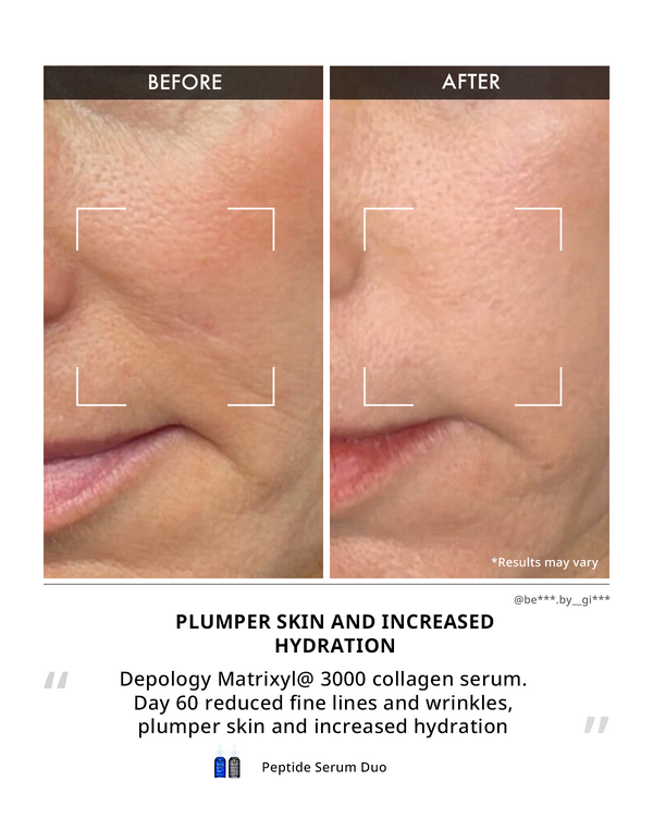 Matrixyl® 3000 Collagen Serum