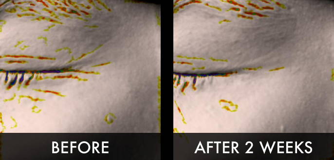 Clinical trial image