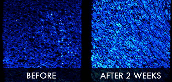 Clinical trial image