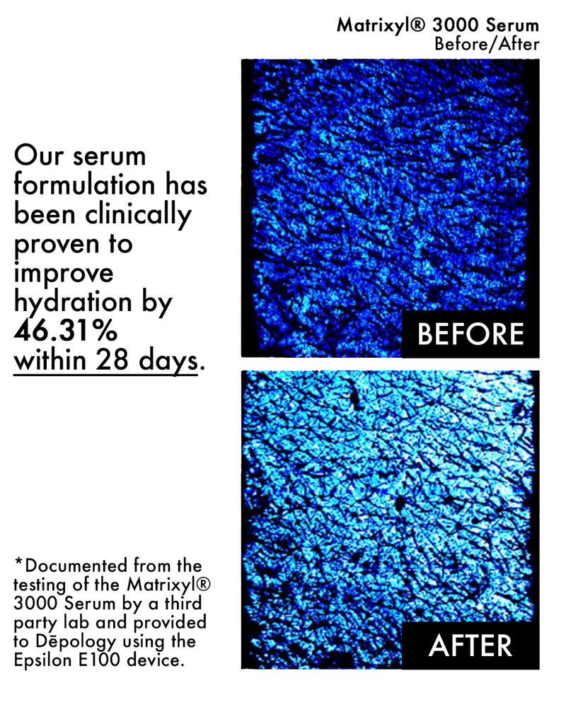 Matrixyl® 3000 Collagen Boosting Serum