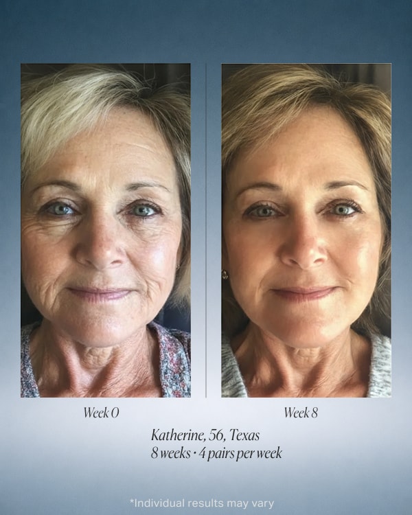 Deepcare + Serum Infused Micro Dart Patches — Advanced Retinol Formula