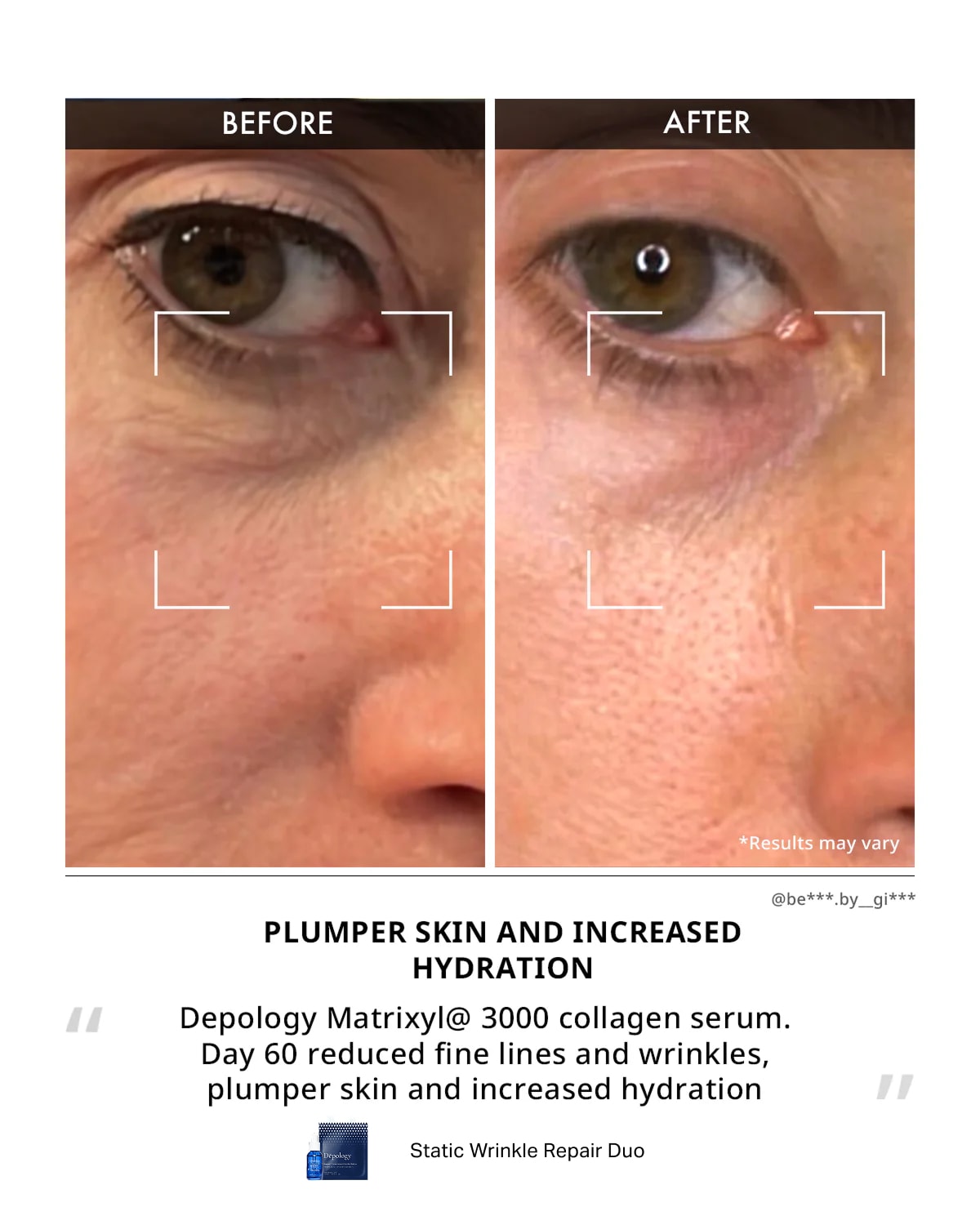 Static Wrinkle Repair Duo