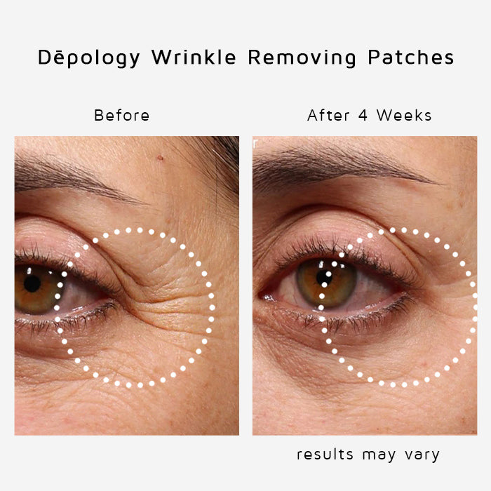 Anti-Wrinkle Eye and Smile Microneedle Patches