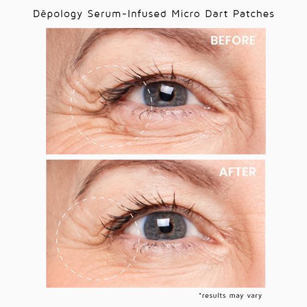 Anti-Wrinkle Serum Infused Micro-Dart Patches